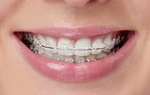 Dentist in Park Ridge