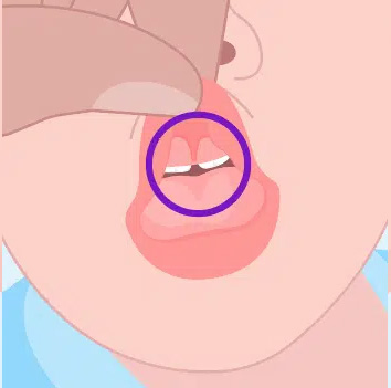 Dentist in Park Ridge