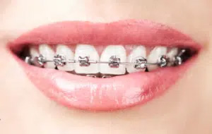 Dentist in Park Ridge