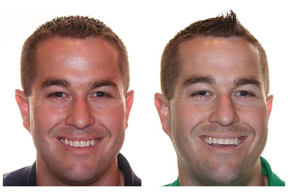 Blue Coral Pediatric Dentistry   Orthodontics