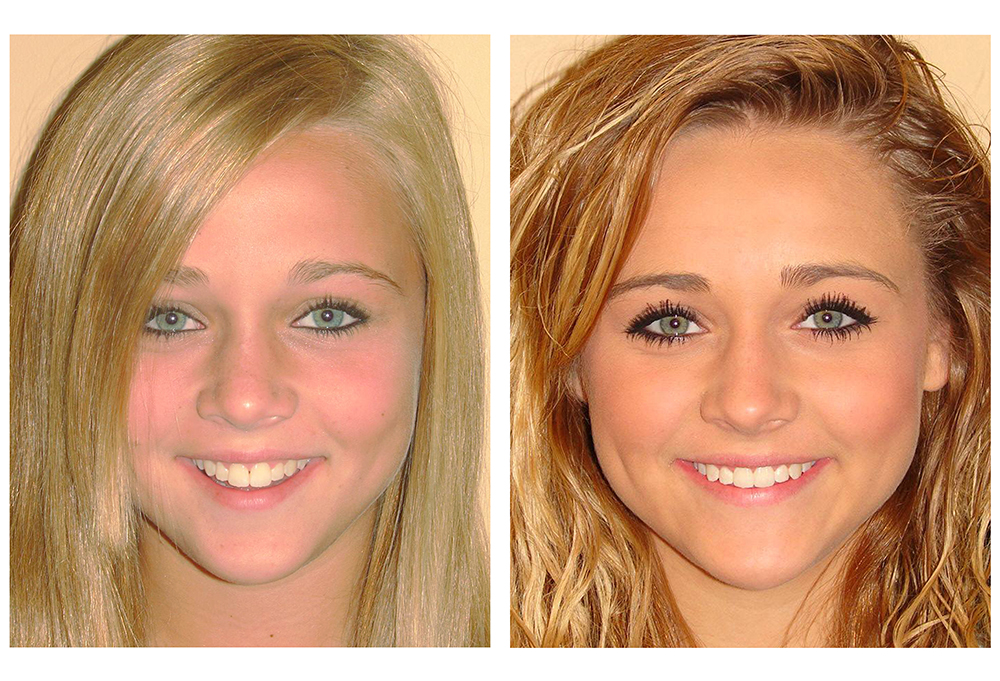 Blue Coral Pediatric Dentistry   Orthodontics